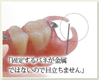 「固定するバネが金属ではないので目立ちません」